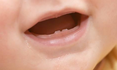 宝宝长牙慢是怎么回事_百科小知识-儿童护理乳牙-牙齿-也会