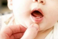 宝宝长牙不按顺序长是什么原因_百科小知识-儿童护理不按-牙齿-也会