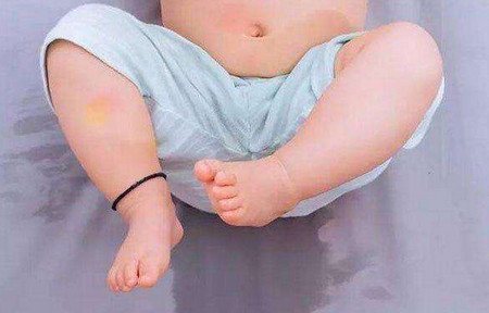 宝宝几岁尿床算正常？什么原因会导致宝宝尿床？_儿童护理上厕所-膀胱-太多