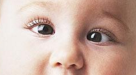 宝宝眼睛斜视的原因分析_儿童护理宝宝-分析-视觉