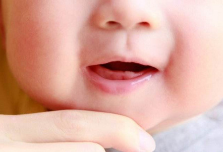 宝宝口腔都会出现哪些问题？_儿童护理症状-口角炎-疱疹