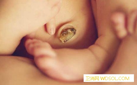 宝宝的脐带多久脱落，新生儿脐带怎么护理_儿童护理什么时候-新生儿-护理