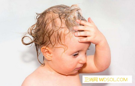 宝宝头发又稀又黄是什么原因_头发-洗头-头皮-睡眠-生长-宝宝-个月-