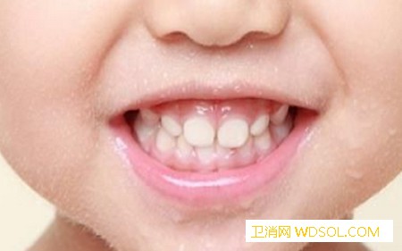 怎么保护宝宝的牙齿_乳牙-龋齿-牙膏-牙齿-