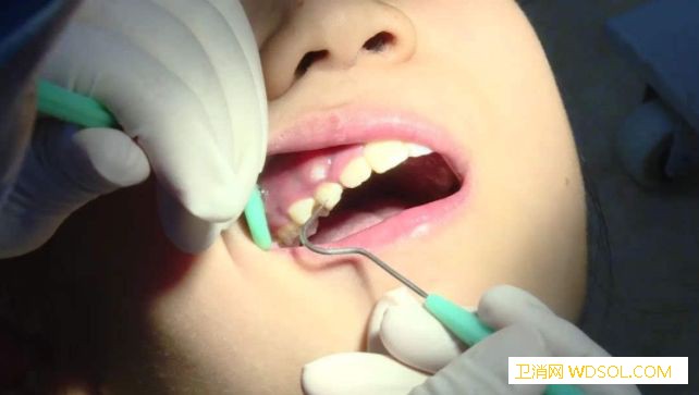 孩子牙齿怎么护理_恒牙-氟化物-乳牙-牙刷-