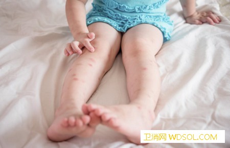 宝宝皮肤擦伤怎么处理_棉签-擦伤-无菌-紫药水-