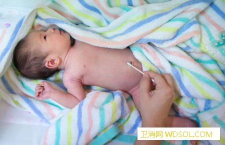 新生儿脐带多久脱落？该怎么护理_脐带-根部-脱落-部位-