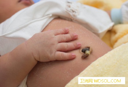 宝宝肚脐肿了怎么办_卵黄-肉芽-脐带-肚脐-