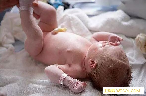 新生儿脐带怎么护理_脐带-喂养-脱落-出血-