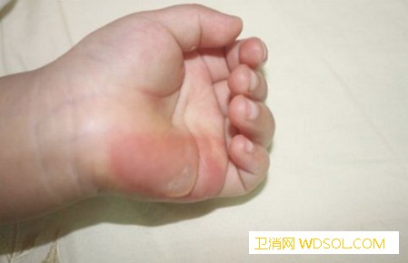 怎么预防宝宝烫伤_热汤-预防措施-桌布-烫伤-