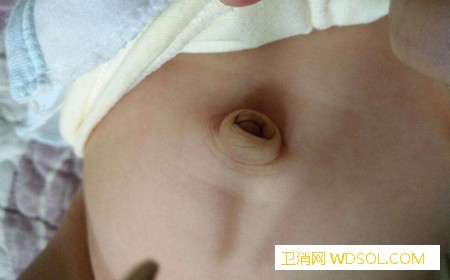 宝宝肚脐眼凸起是脐疝？_腹腔-闭合-肚脐-发育-