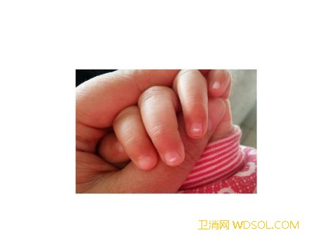 宝宝指甲上有白点该怎么办_磕碰-白点-上有-寄生虫-