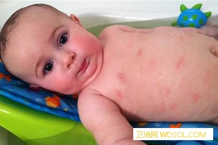 怎样减少宝宝过敏性疾病的发生？_免疫力-性疾病-母乳喂养-减少-