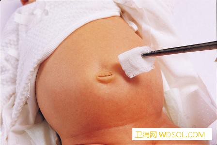 新生儿脐带出血怎么护理_卵黄-脐带-分泌物-根部-