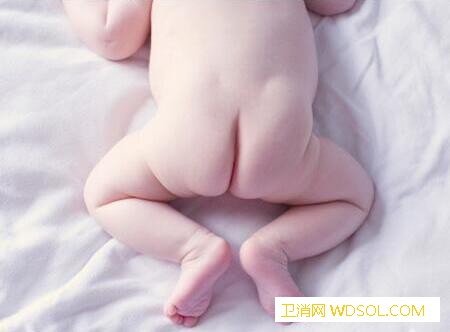 新生儿假性月经的症状_分泌物-女婴-阴道-子宫-