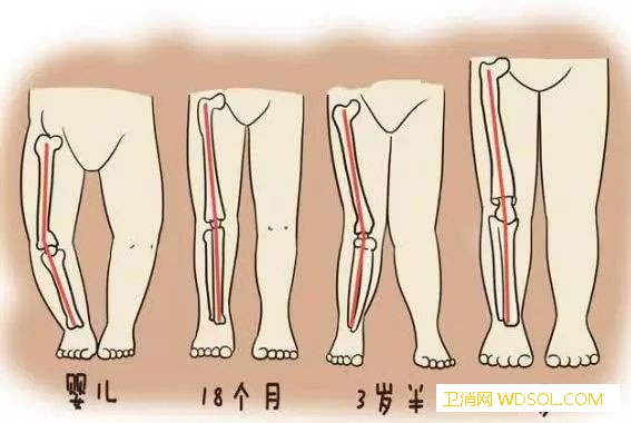 宝宝哪些大动作不宜做早_罗圈腿-站立-走路-动作-