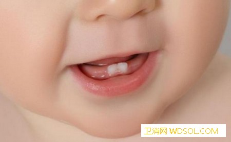 关于宝宝牙齿的问题有哪些_长牙-恒牙-乳牙-牙缝-