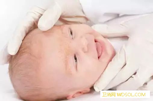 冬天宝宝湿疹的六个原因_湿疹-诱发-干燥-护理-