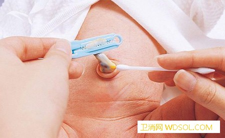 宝宝脐部护理要注意什么_创面-脐带-擦拭-消毒-