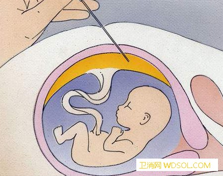 孕妇喝水能补充羊水吗_羊水-妊娠-胎儿-终止-