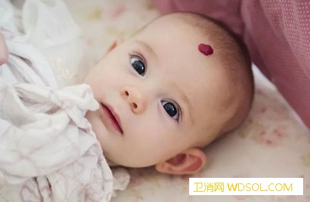 宝宝胎记是怎么造成的宝宝常见的胎记有哪些_血管性-会有-胎记-皮肤-