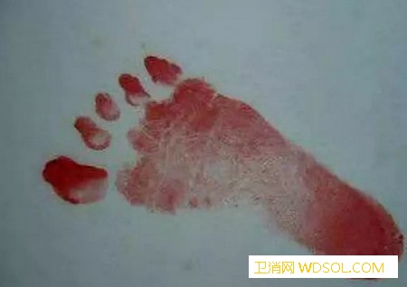 宝宝出生后为什么医院要留脚印_这个时候-脚印-出生-宝宝-