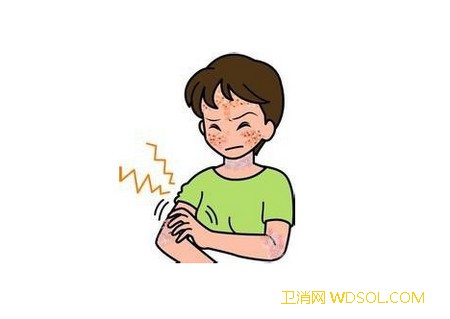 冬季宝宝怎么防静电_物体-静电-接触-皮肤-