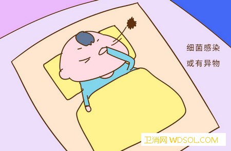 宝宝频繁眨眼是怎么回事_眨眼睛-频繁-家长-导致-