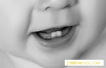 宝宝牙齿发育异常表现有哪些_恒牙-缺额-乳牙-牙齿-