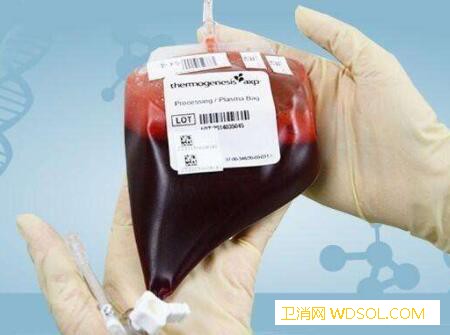 新生儿脐带血保存价格_移植-储存-造血干细胞-血库-