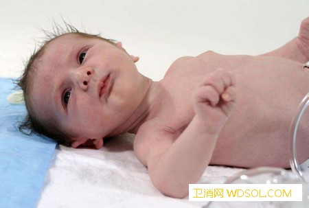 新生宝宝身体出现这4种“异常”不用担心_黄疸-脐带-脱落-宝宝-