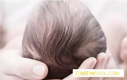 宝宝头发竖着长正常吗？_疳积-脾胃-头发-营养不良-