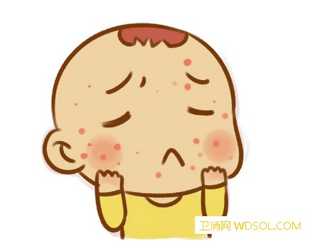 关于宝宝湿疹我们需要了解的事情有哪些_瘙痒-湿疹-婴儿-性皮炎-