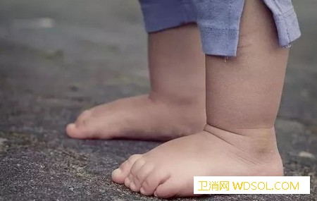影响孩子长高的五种因素_摄入-长高-营养-孩子-