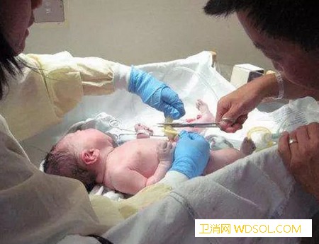 宝宝刚出生的时候医生会做什么_脐带-会在-会将-刚出生-