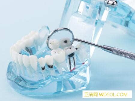 儿童牙列不齐活动矫正器有哪些_上颚-矫治-牙齿-扩张器-