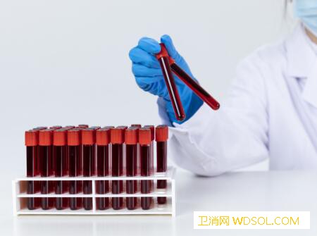 小儿生长激素缺乏症怎么检查_生长激素-染色体-峰值-矮小-