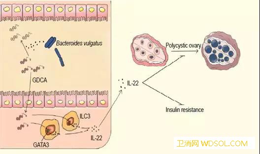 自然医学发表北大第三医院乔杰院士团队多囊卵巢_北京大学-胆汁-肠道-胆酸